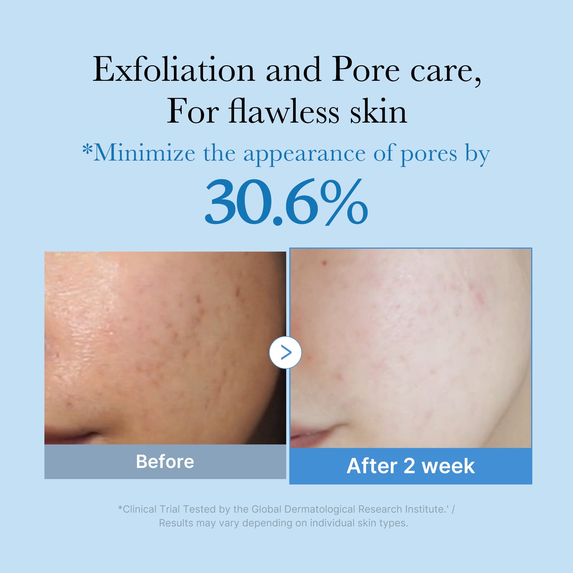 Zero Pore Toner M6