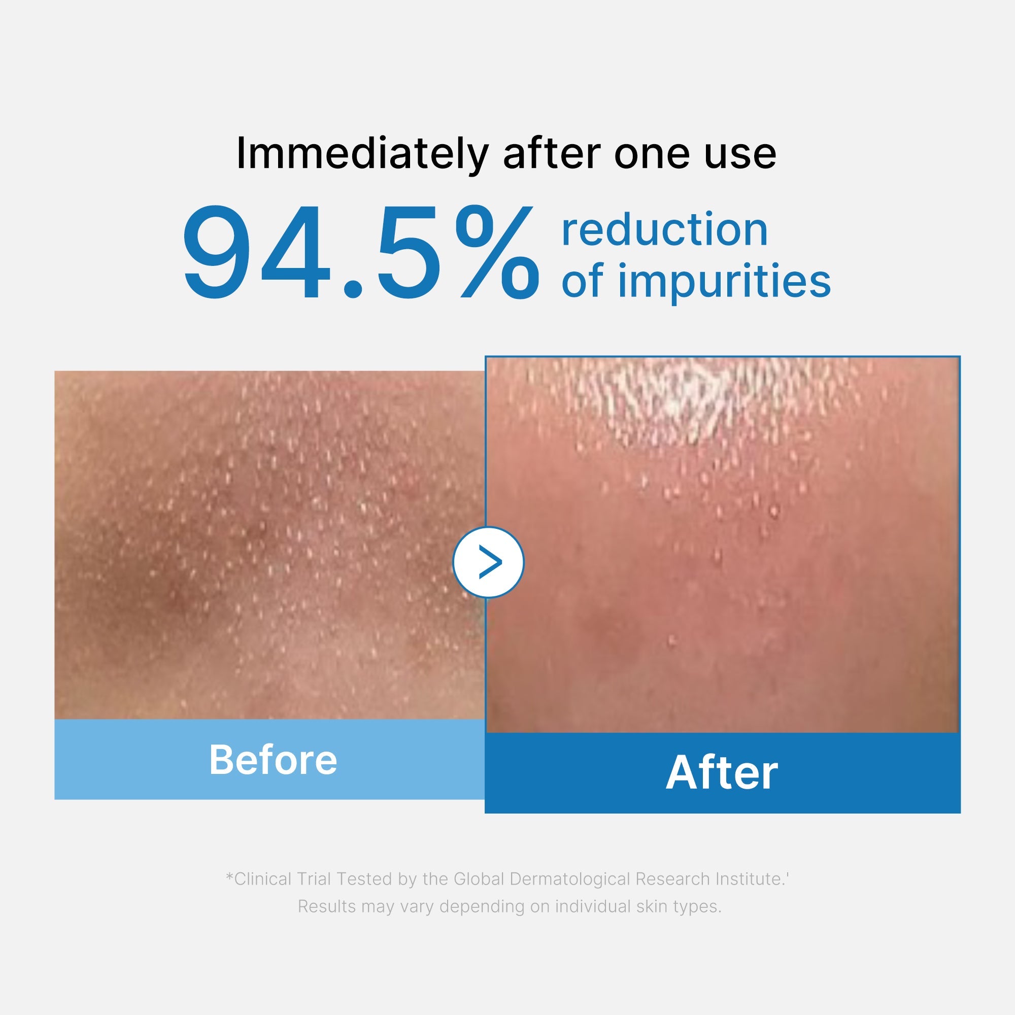 Zero Pore Blackhead Deep Cleansing Oil W5