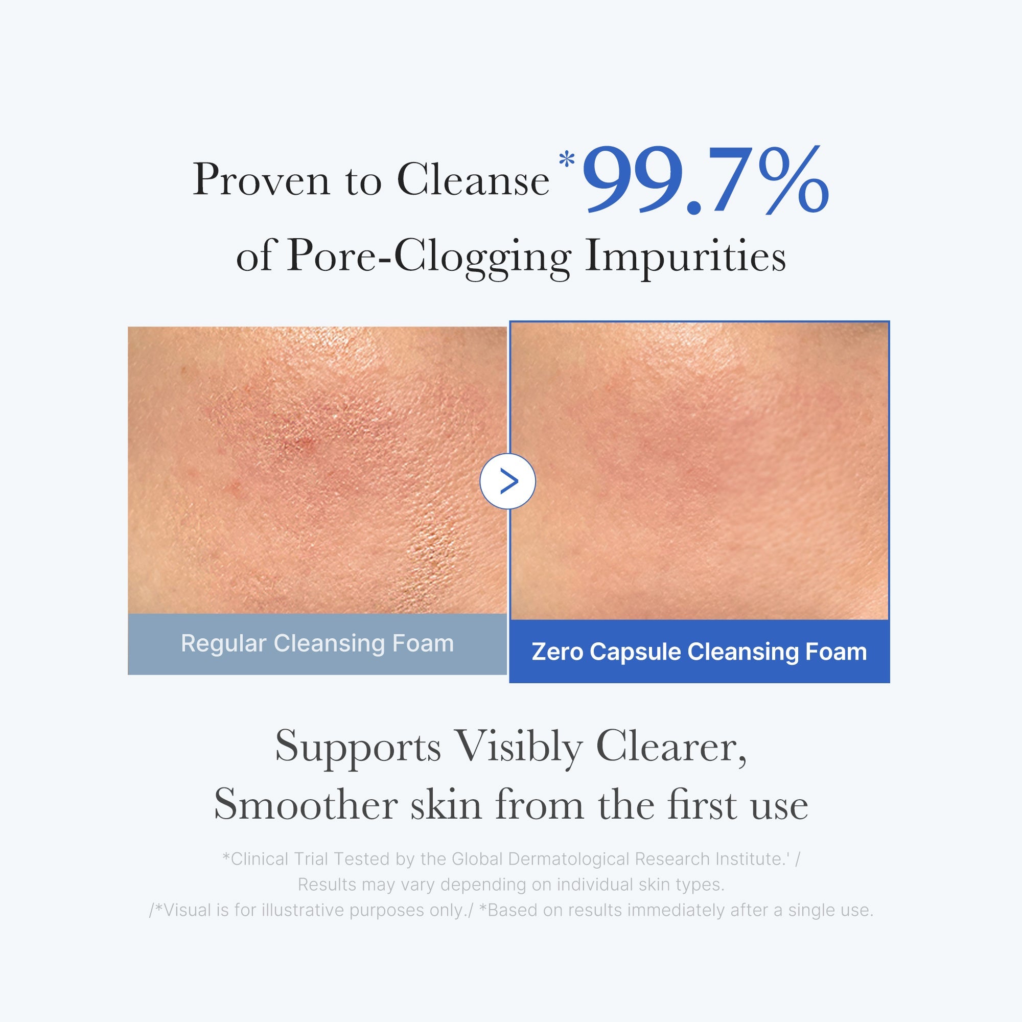 Zero Pore Capsule Cleansing Foam X0