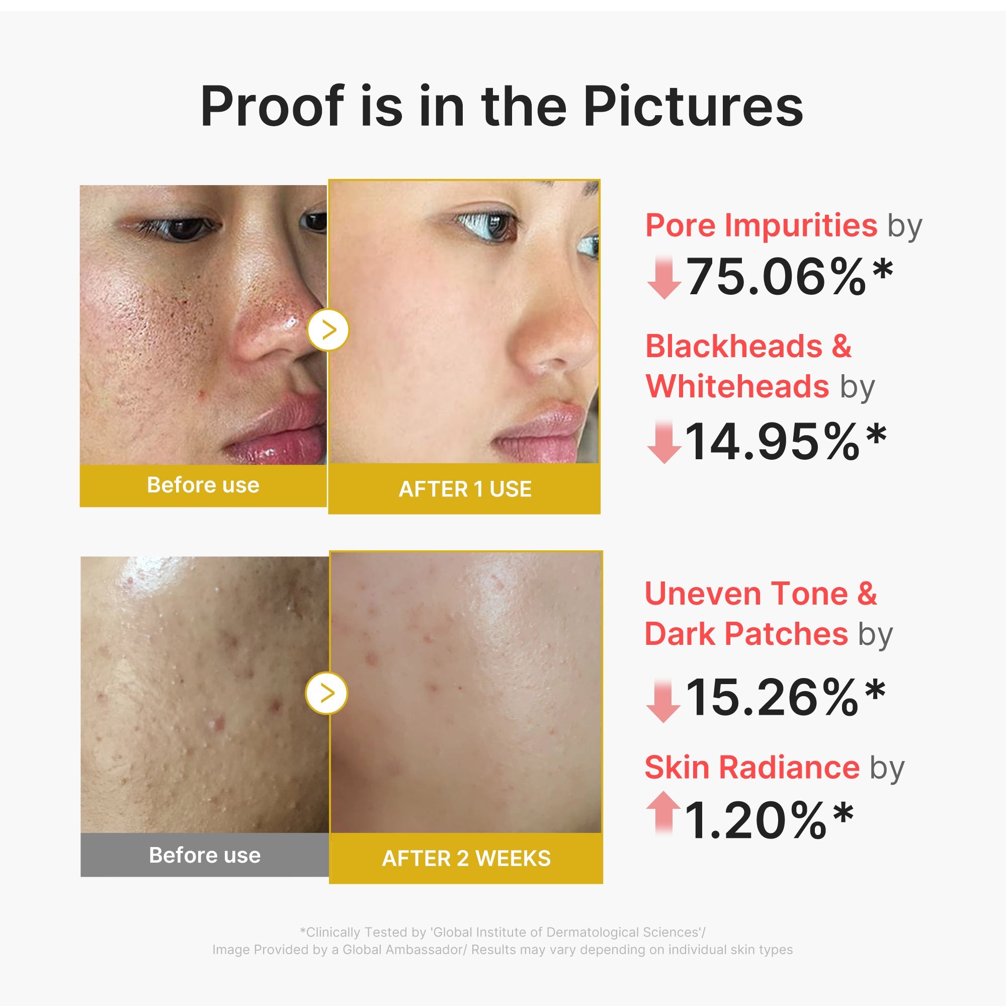 Kojic Acid Turmeric Peel Shot H9