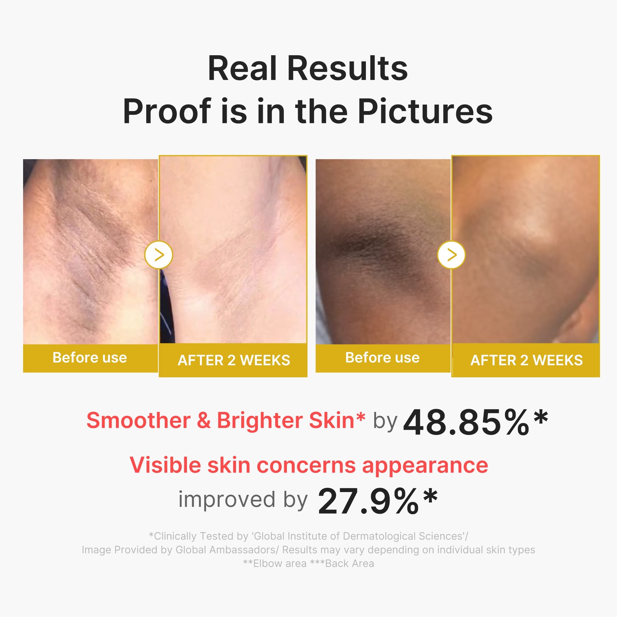 Kojic Acid Turmeric Body Peel Shot T5