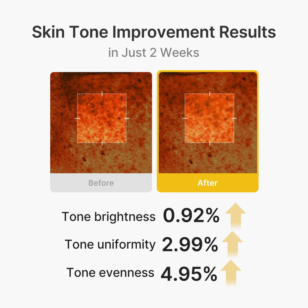 Kojic Acid Turmeric Vita Capsule Cream W7