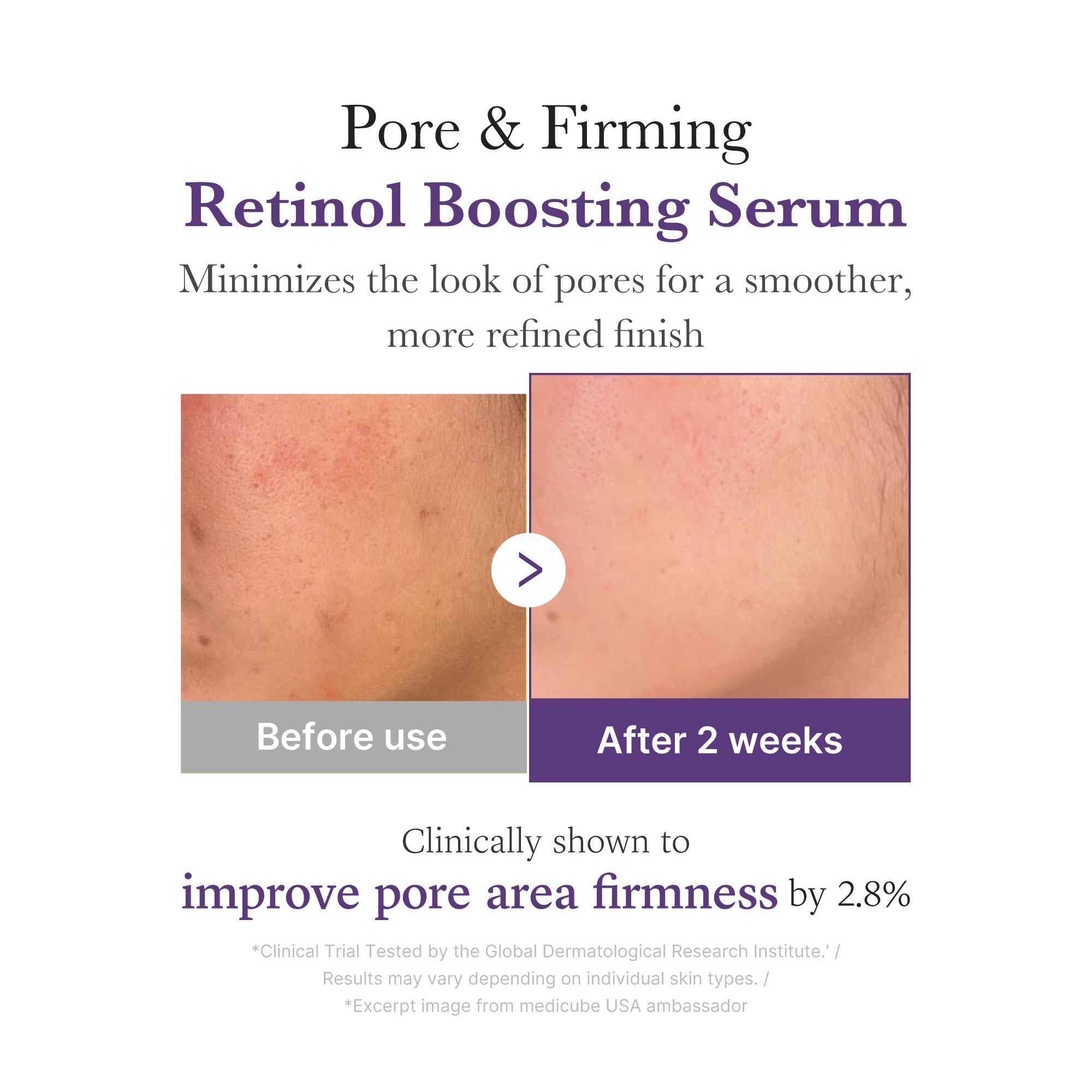 Retinol NMN Boosting Serum E3