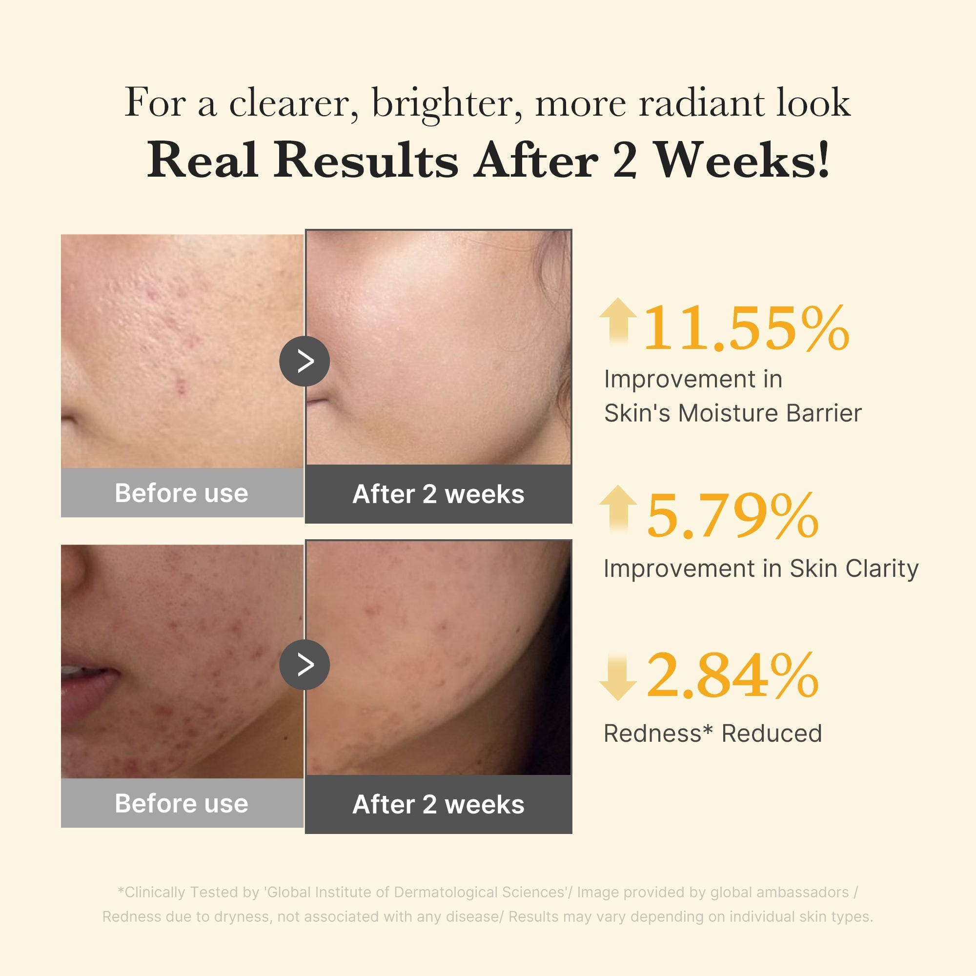 Kojic Acid Turmeric Capsule Serum O8