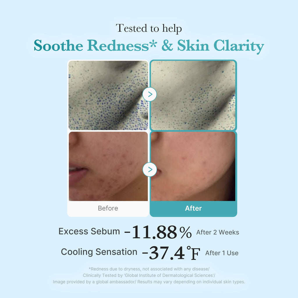 Azelaic Acid Niacinamide Clarifying Toner R1