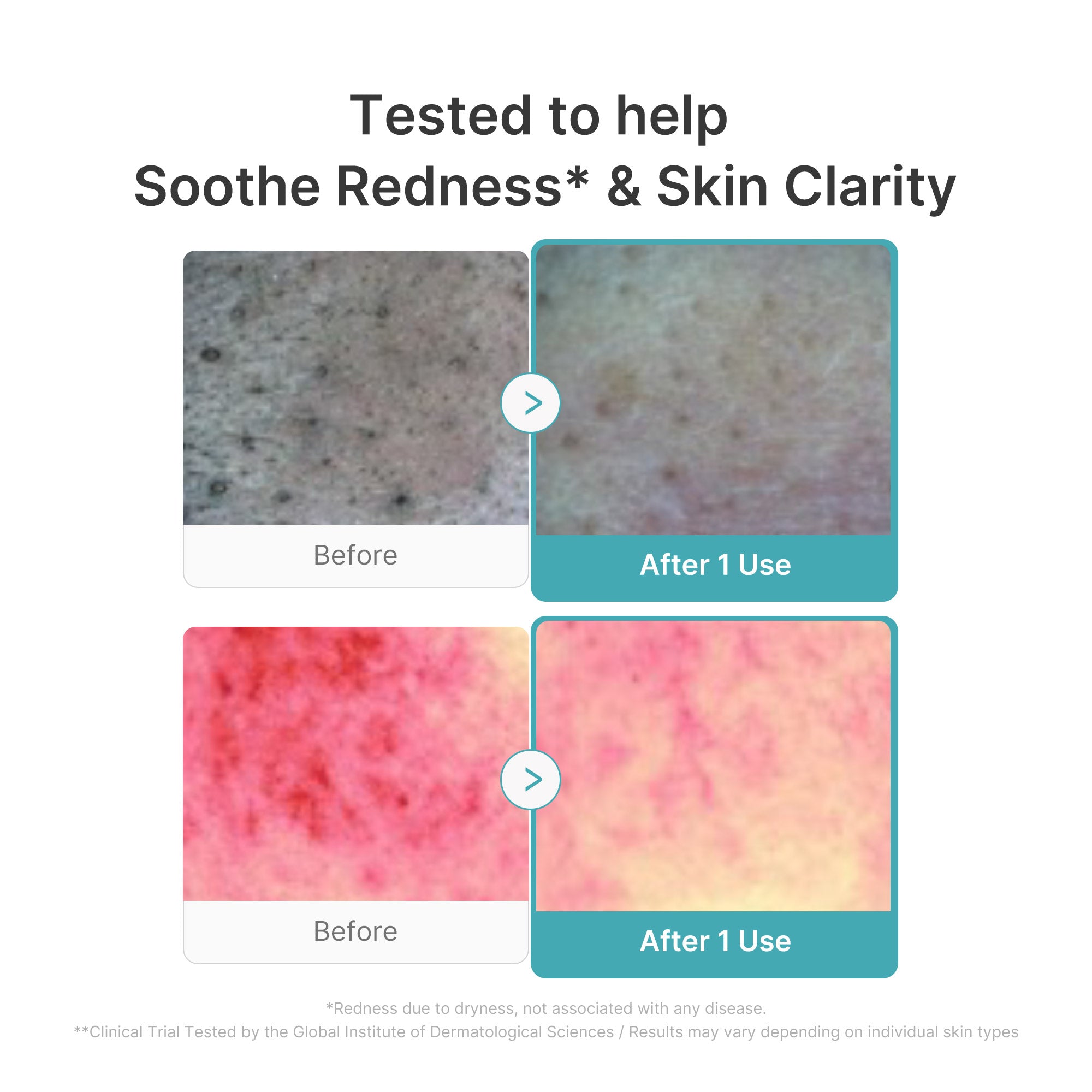 Azelaic Acid Capsule Foam Cleanser G0