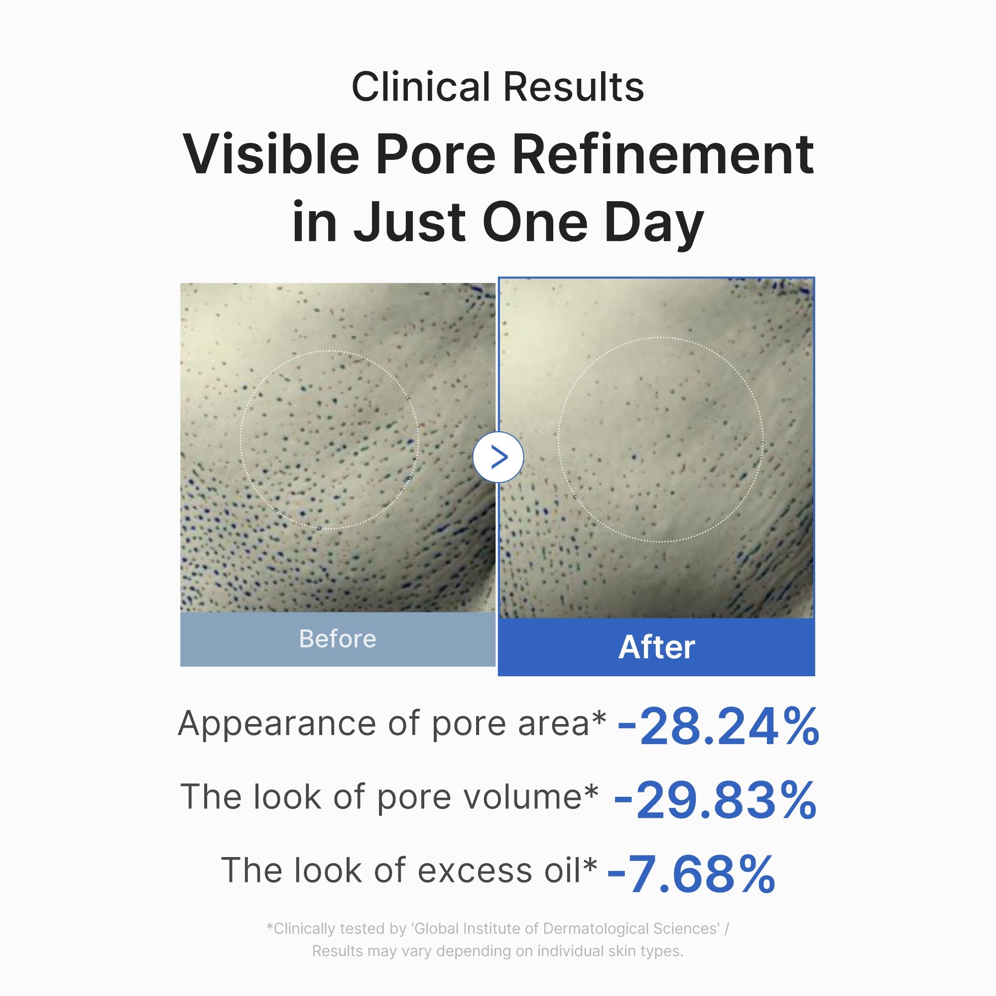 Pore Care Duo J6
