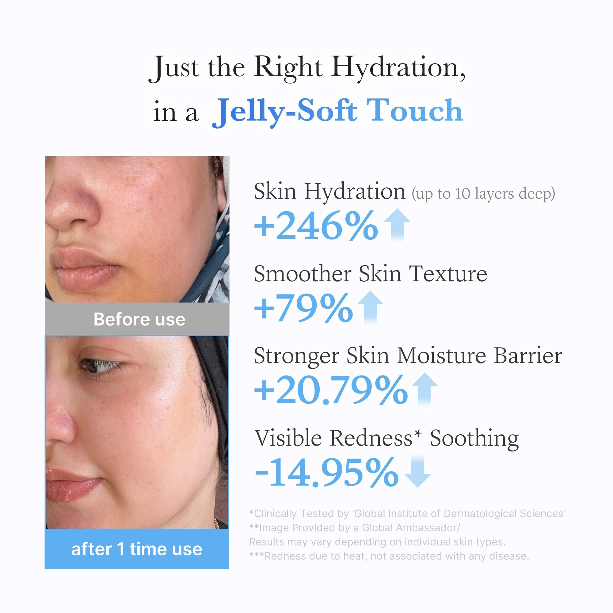 Hyaluronic Ceramide Moisturizing Jelly Cream X6