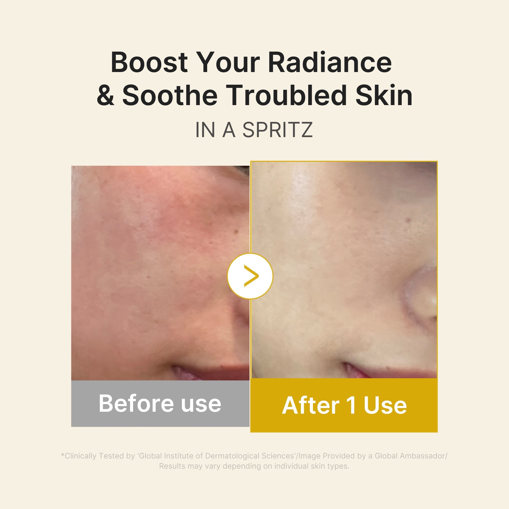 Kojic Acid Turmeric Vitamin Gold Jelly Mist Serum Z1