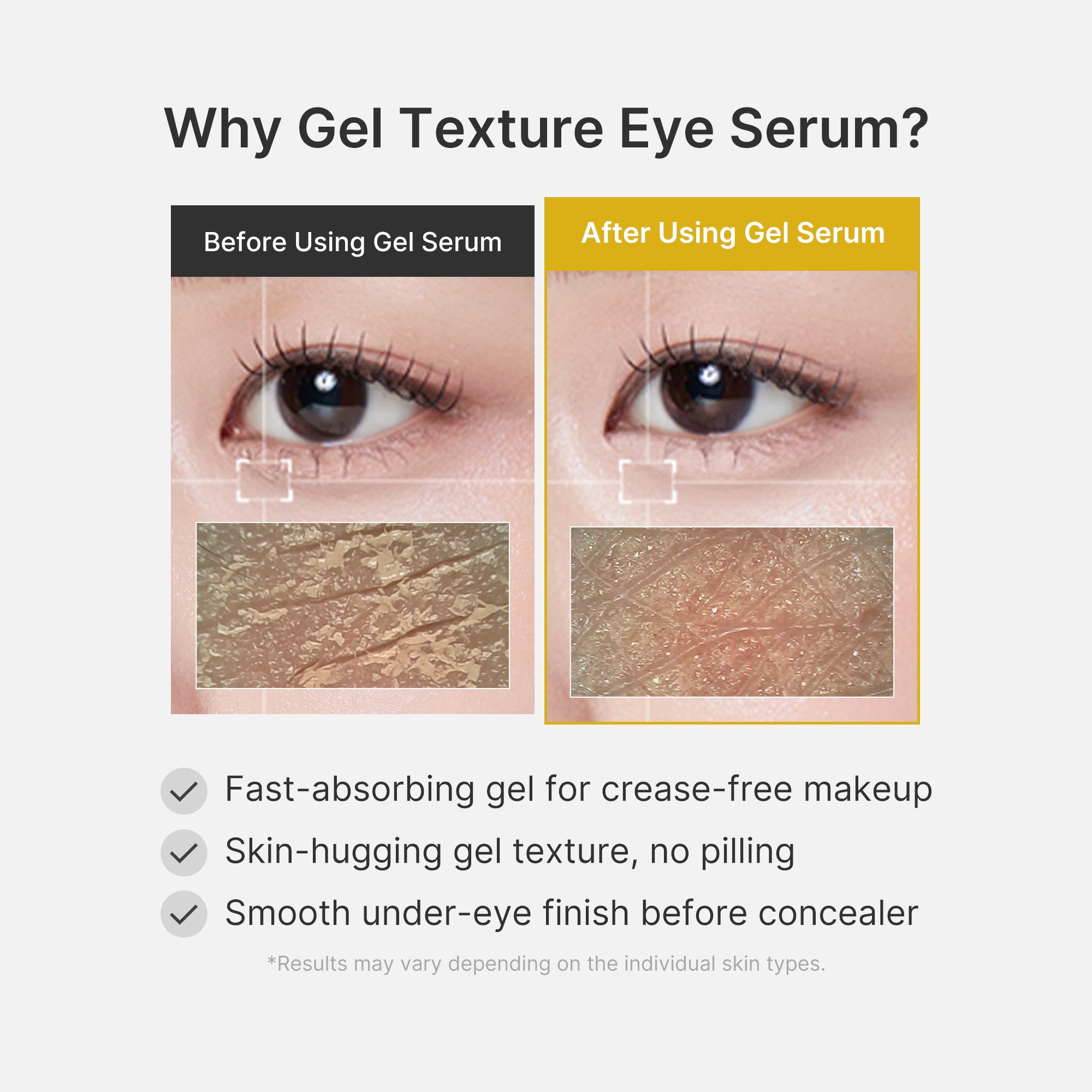 Kojic Acid Tumeric Eye Gel Serum Z3