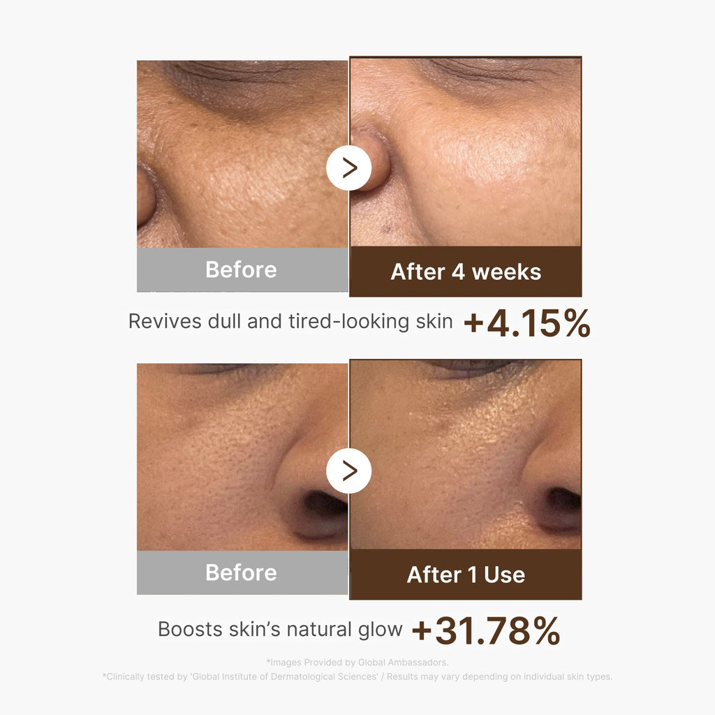 Deep Vitamin C Capsule Serum Y2