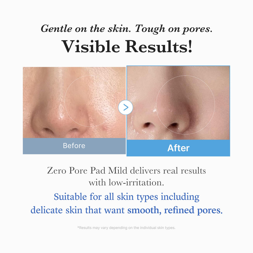 Zero Pore Madecassoside Pads (Mild) Z4