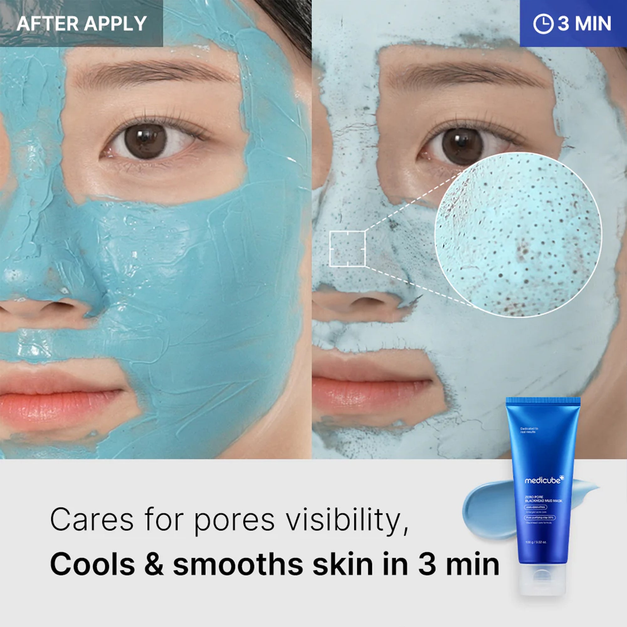 Zero Pore Blackhead Mud Mask X4