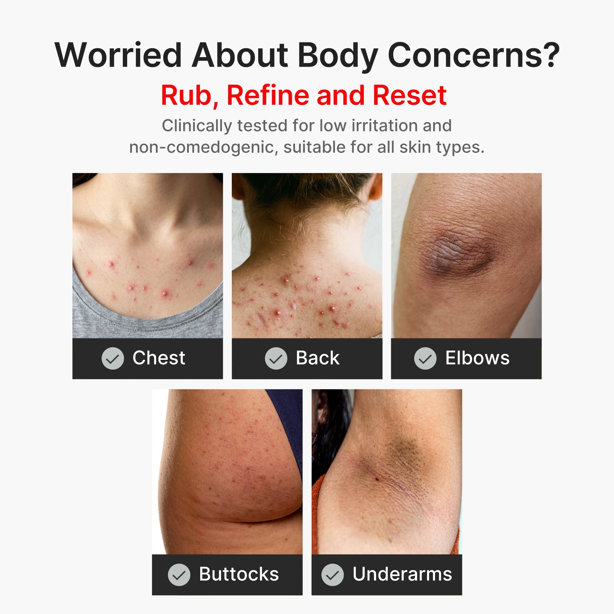 Kojic Acid Turmeric Body Peel Shot T5