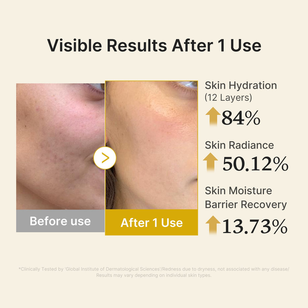 Kojic Acid Turmeric Vitamin Gold Jelly Mist Serum Z1