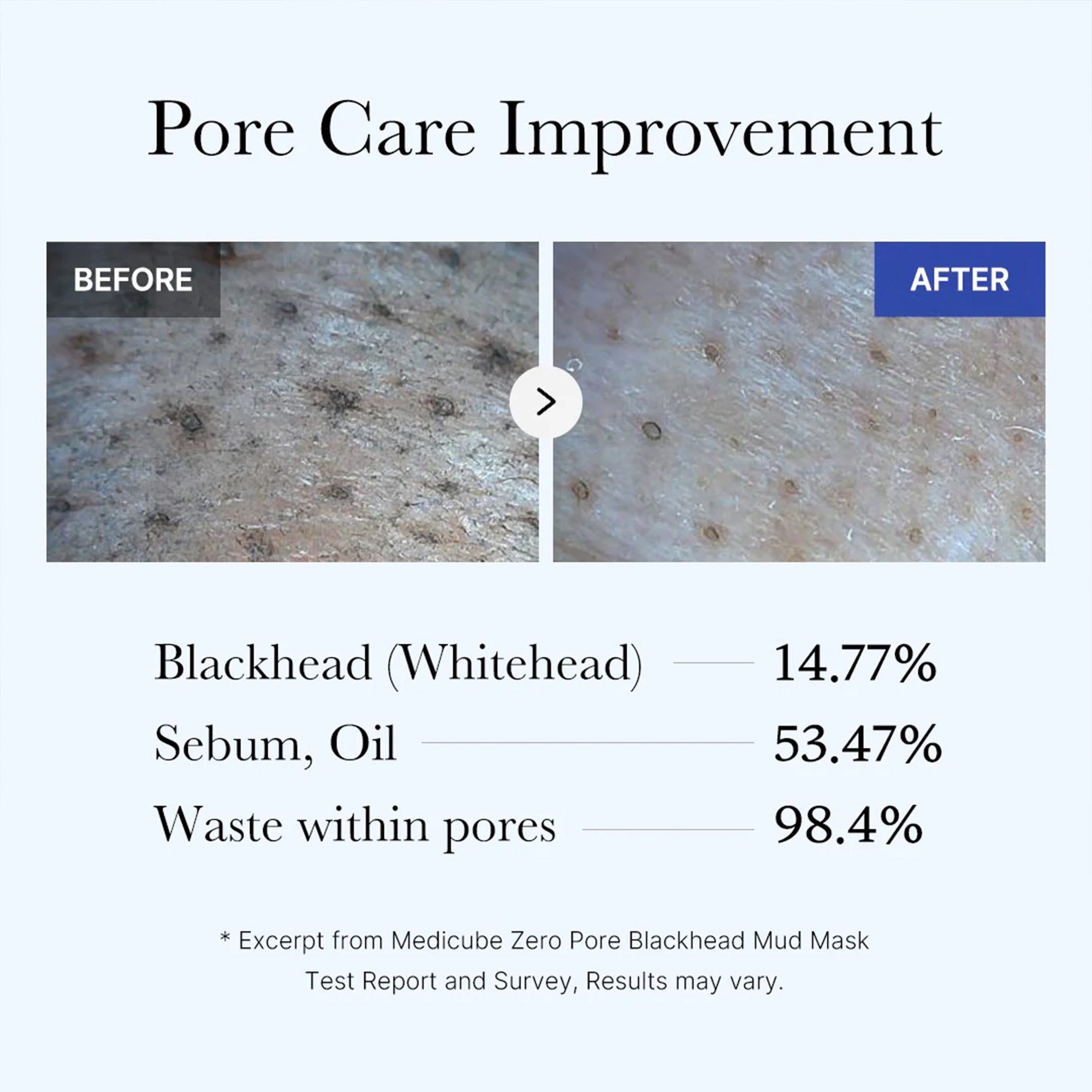 Zero Pore Blackhead Mud Mask X4
