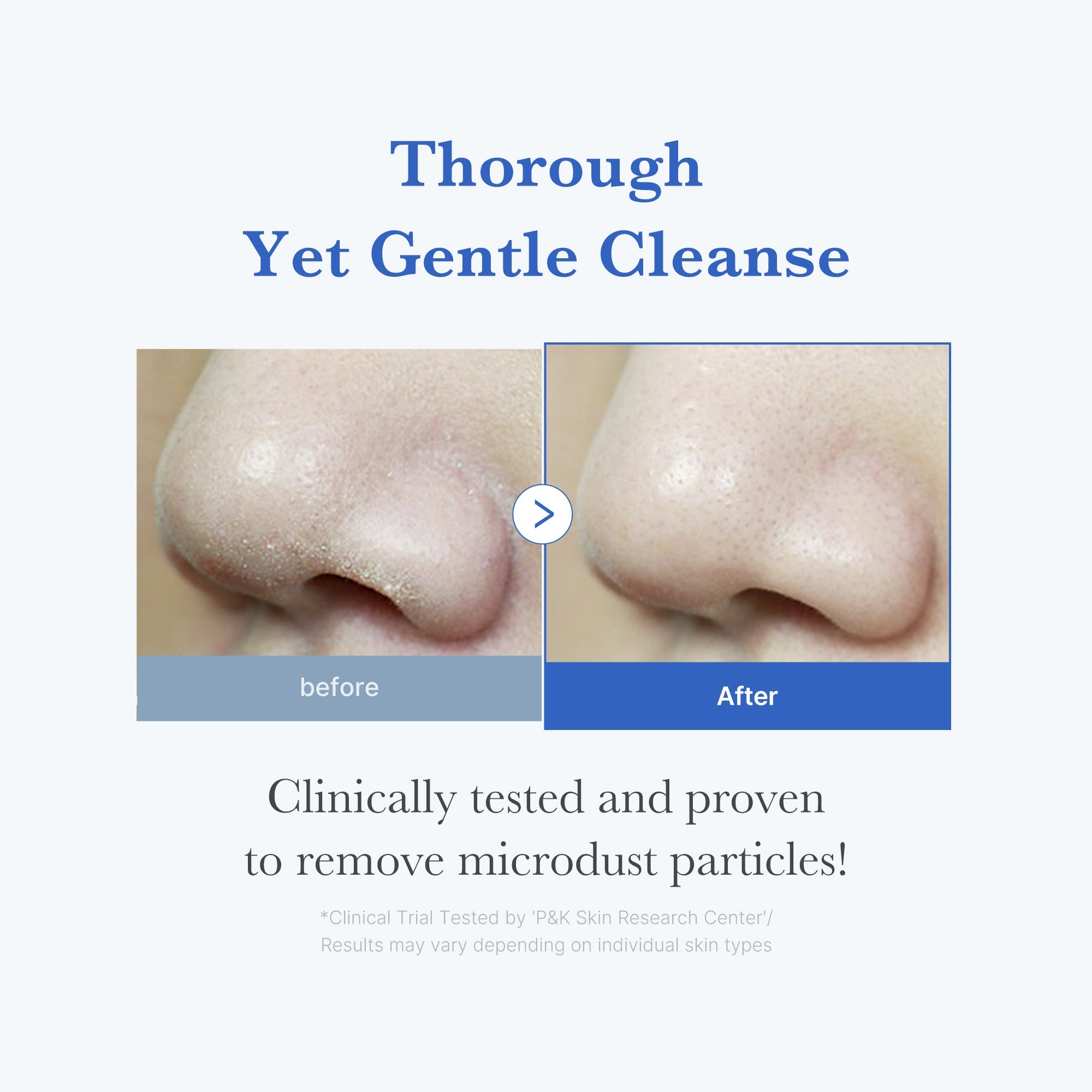 Zero Foam Cleanser Q2