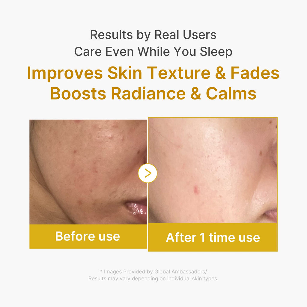 Kojic Acid Turmeric Overnight Wrapping Mask C0