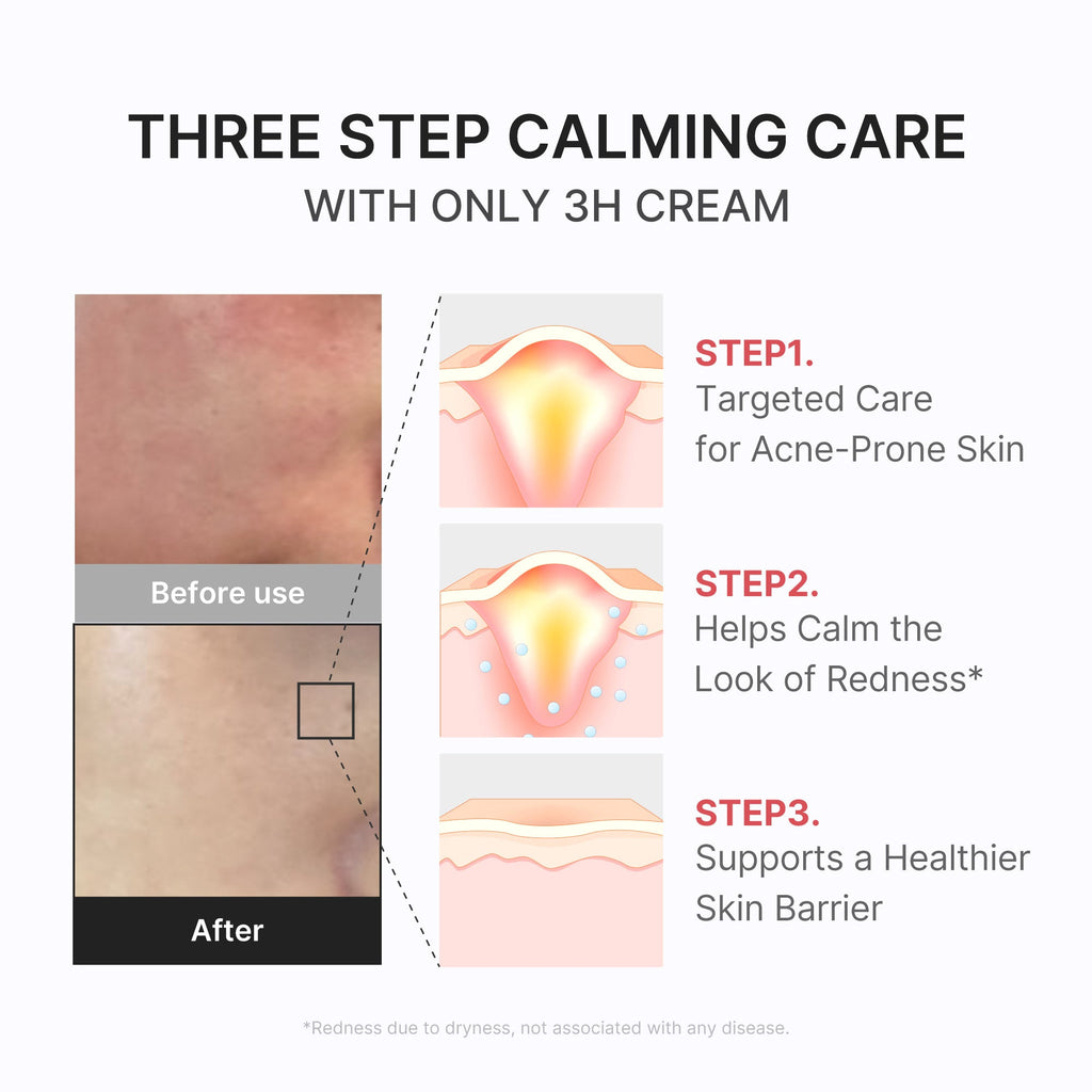 3H Daily Relief Cream P4