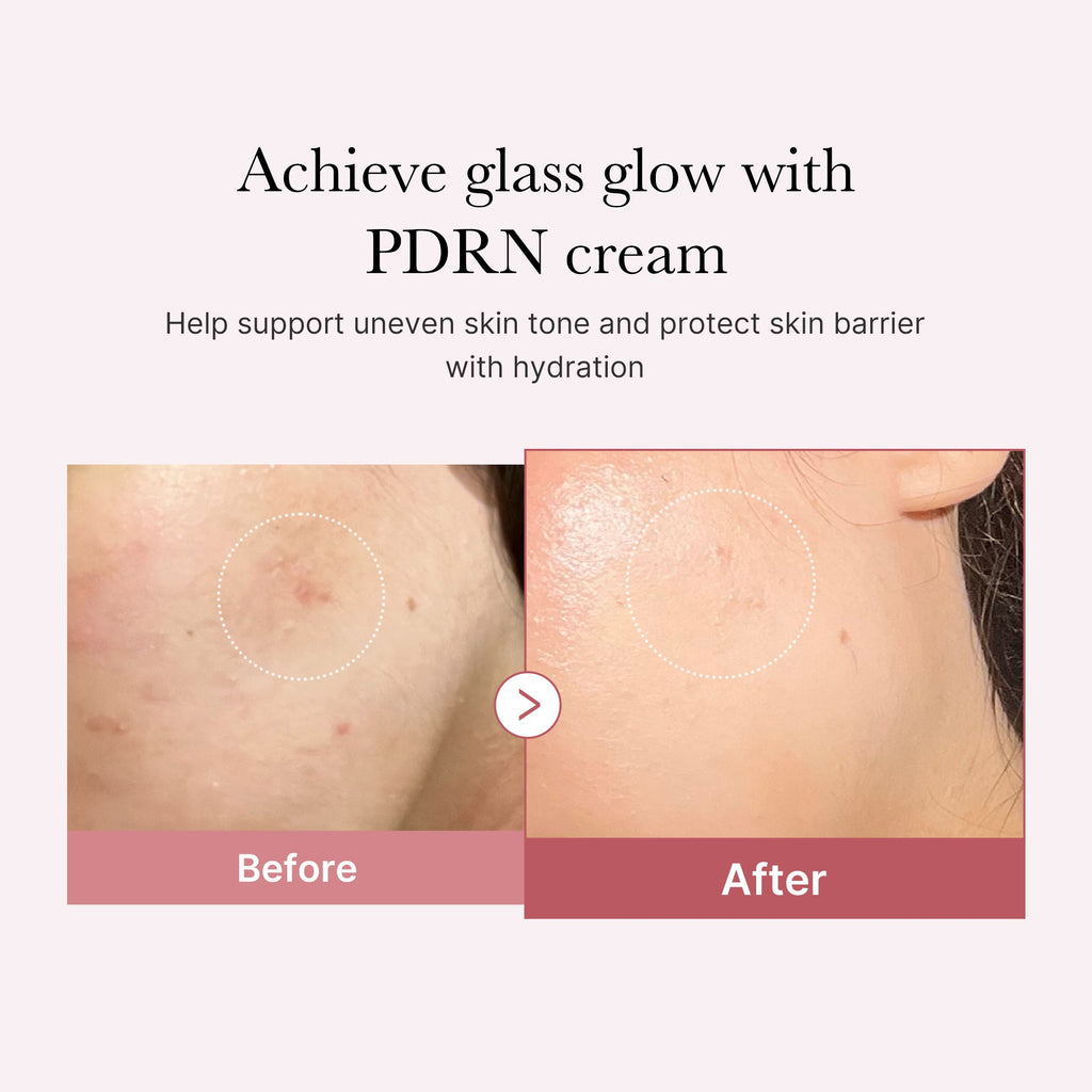 PDRN Pink Peptide Cream I1