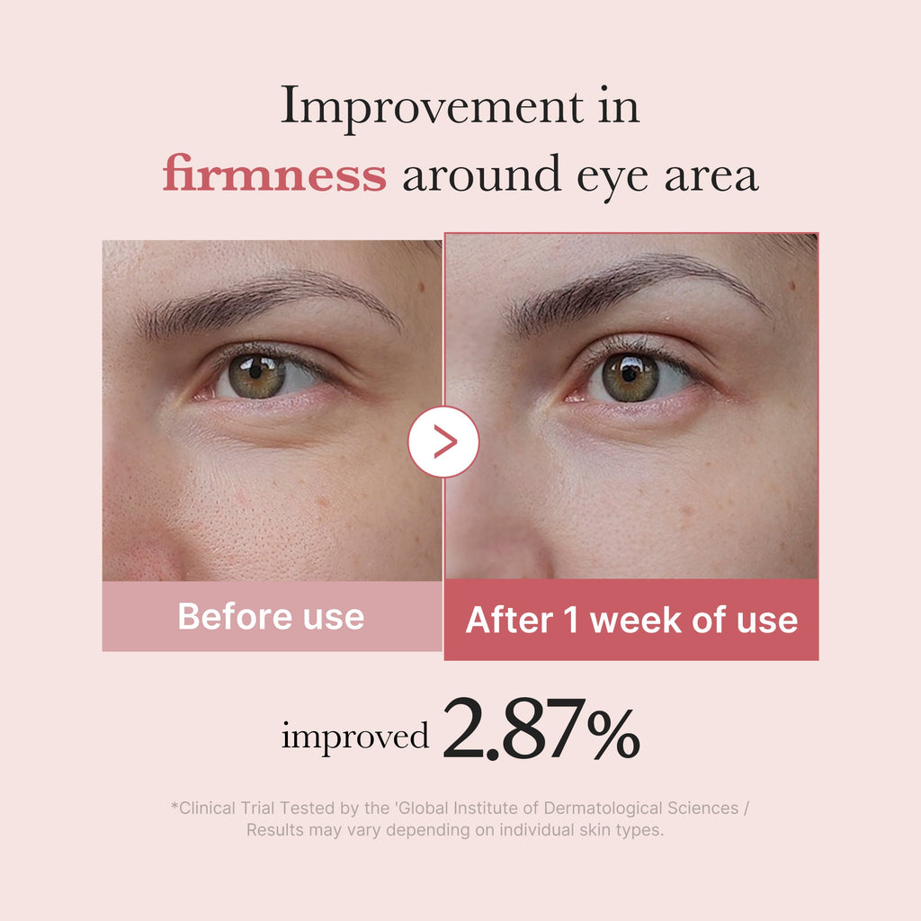 PDRN Pink Peptide Eye Cream D8