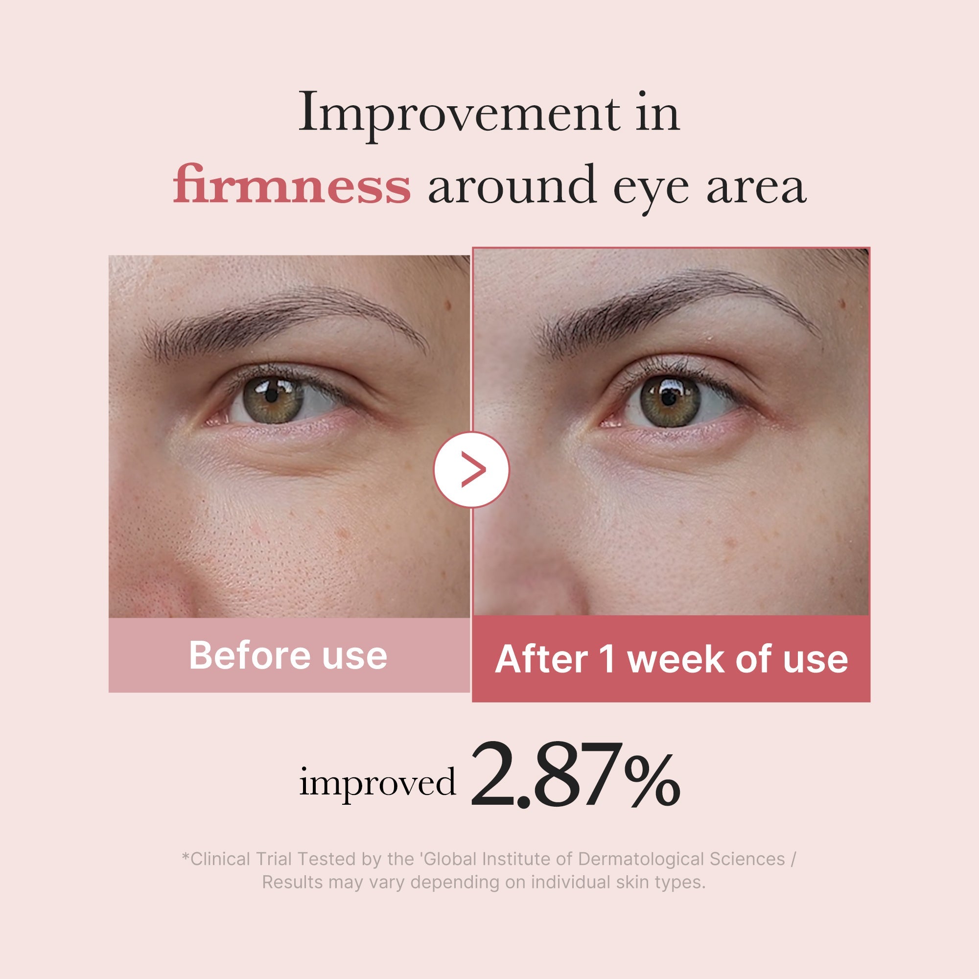 PDRN Pink Peptide Eye Cream D8