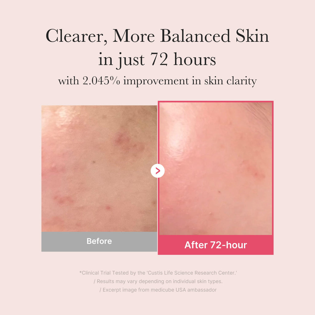 TXA Niacinamide Serum X8