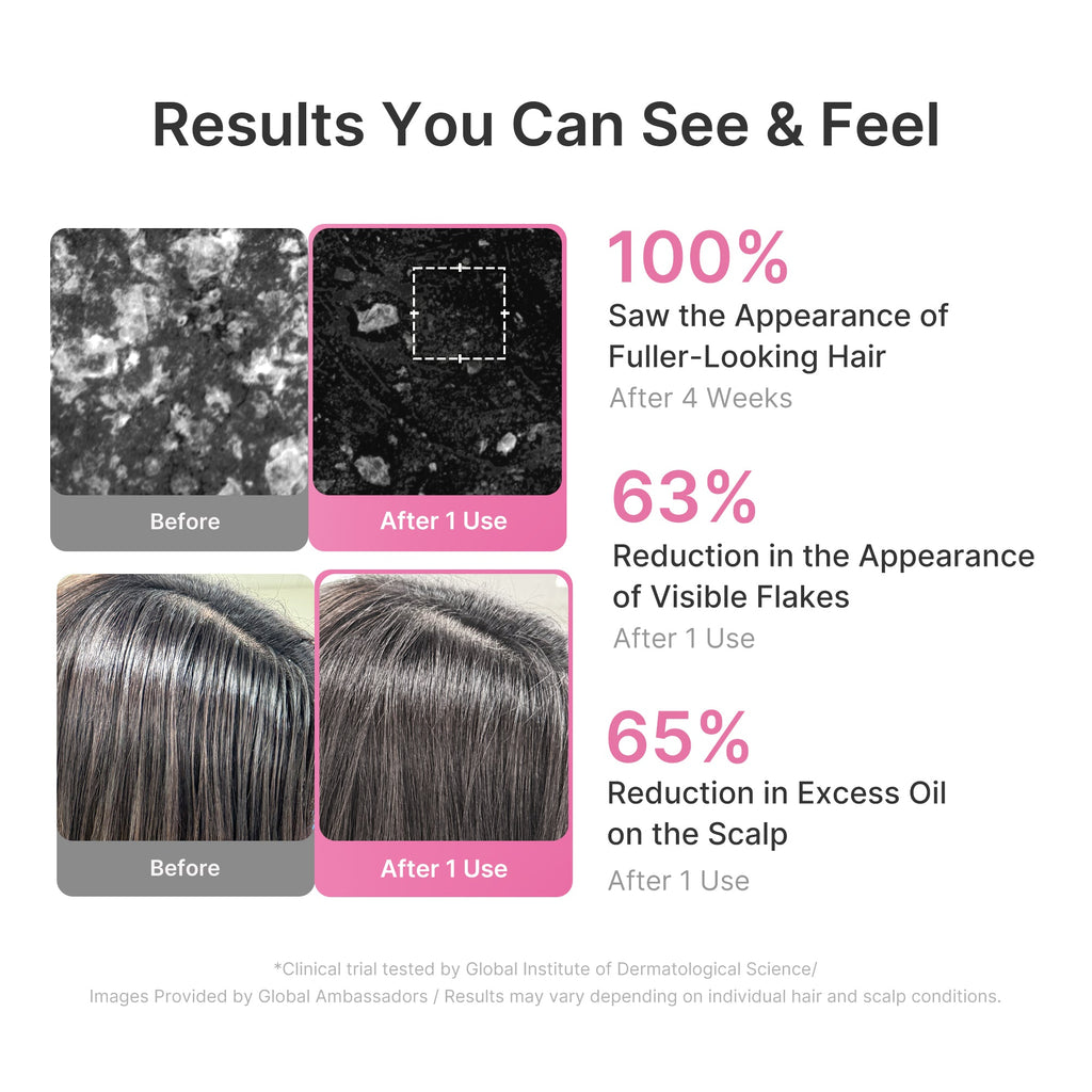 Rosemary PDRN Cooling Thickening Shampoo E9