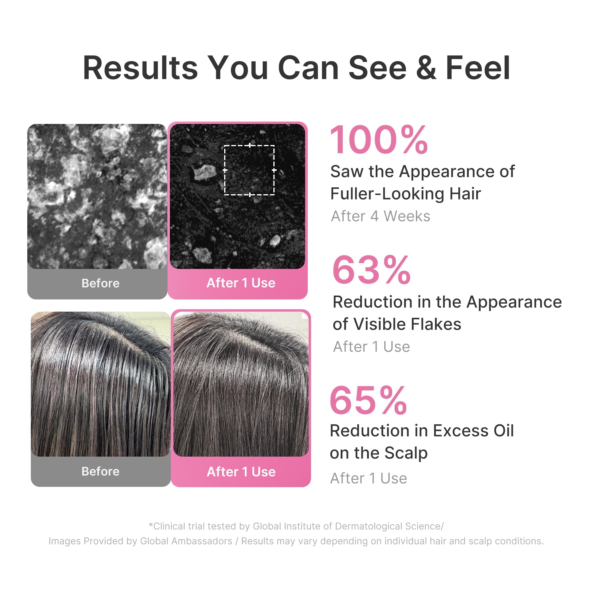 Rosemary PDRN Cooling Thickening Shampoo E9